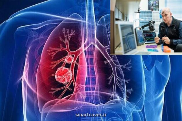 ابداع جدید پژوهشگر ایرانی برای پایش علائم بیماریهای تنفسی