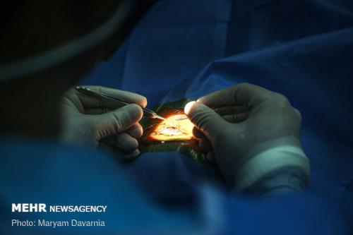 افقی تازه در درمان زخم های شدید قرنیه با بهره گیری از سلول های بنیادی