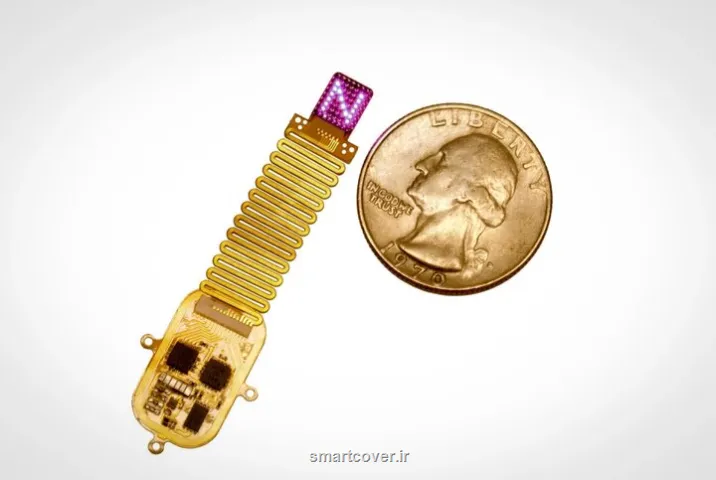 ایمپلنت جدید حواس مرده را زنده می کند