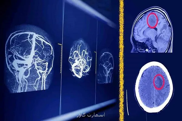 پیش بینی آینده رادیولوژیست ها باوجود هوش مصنوعی