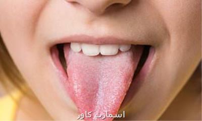 شناسایی سلول های چشایی جدیدی كه همزمان همه طعم ها را تشخیص می دهند