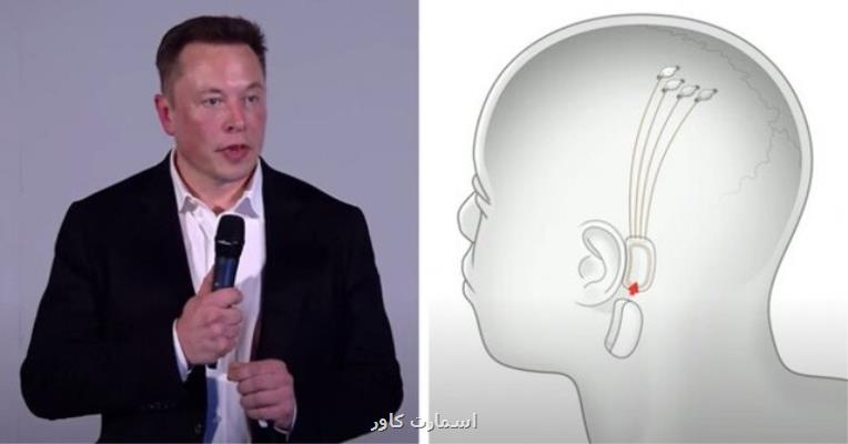 ایلان ماسك در یك رویداد زنده اطلاعات جدیدی درباره نورالینك فاش می كند