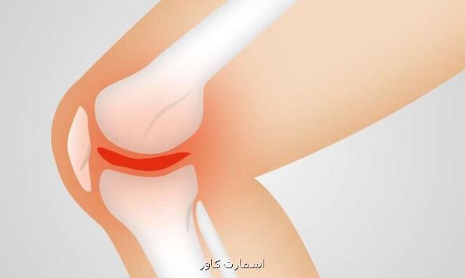 علت دردهای گوناگون افراد مبتلا به آرتروز زانو چیست؟